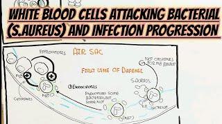 White Blood Cells Attacking Bacterium(S.aureus) Infection @umerfarooqbiology7083