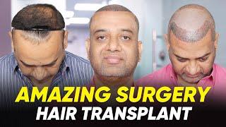 Hair Transplant in Delhi | Best Results & Cost of Hair Transplant in Delhi