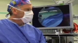 Minimally Invasive Surgery - Step by Step - The Children's Hospital of Philadelphia (3 of 5)