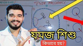 যমজ সন্তান কিভাবে হয় | What is Dichorionic and Monochorionic twin pregnancy