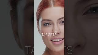 ACNE - Accutane