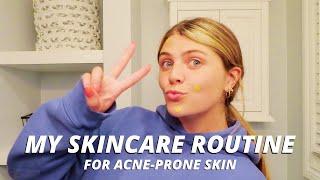 MY SKINCARE ROUTINE FOR ACNE-PRONE SKIN // how to get rid of acne & keep your skin clear