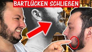 Bartlücken Füllen | Woche 12