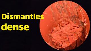 Dismantles dense wax. wax Icleaning | ASMR|relaxation | relax