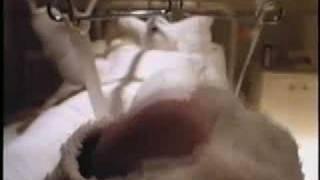 Got Milk "Body Cast" Commercial (1995)