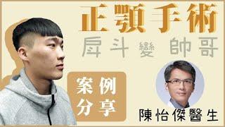 【台中正顎手術｜案例分享】被戽斗耽誤的大男孩!！正顎脫離邊緣人！｜整形外科陳怡傑醫師