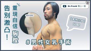 【案例分享】激凸OUT！男人味IN｜男乳縮胸手術