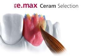 IPS e.max Ceram Selection