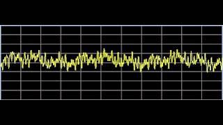 Inflammation - Rife Frequencies