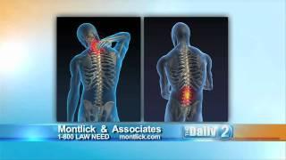 Soft Tissue injuries by MONTLICK & ASSOCIATES, Georgia Auto Accident Attorneys. www.montlick.com