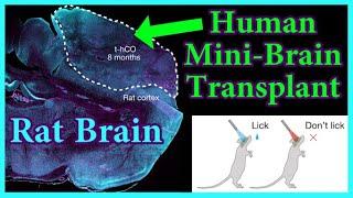 Scientists Gave Human Brain Cells to a Rat. Why?