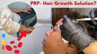 PRP TREATMENT FOR HAIR LOSS & THINNING AFTER HAIR TRANSPLANT- Preparation, Do's & Don'ts, The Pain..