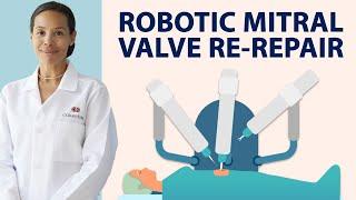 Surgeon Q&A: Robotic Mitral Valve Re-Repair with Dr. Joanna Chikwe