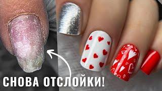 ОТСЛОЙКИ НА НОГТЯХ! В чем причина? ДИЗАЙН ногтей на 14 ФЕВРАЛЯ