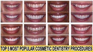 Top 5 Most Popular Cosmetic Dentistry Procedures #shorts #cosmeticdentistry #smilemakeover