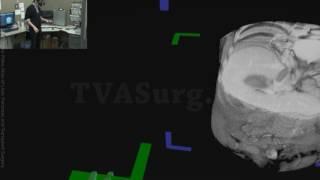 TVASurg Medical Imaging VR Module