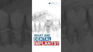 Dental Implants in Thailand: Implantologist in Thailand Explains It All!