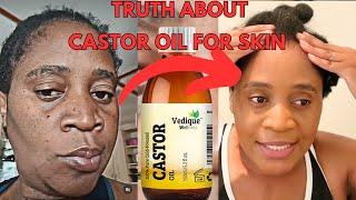 Castor Oil for your face shocking Truth About Castor Oil On The Skin/  Benefits Of Castor  Oil