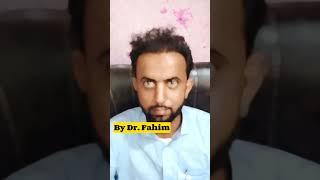 Best Hair Transplant Surgery || Dr Fahim Hair Transplant || Hair Transplant FUE #shorts