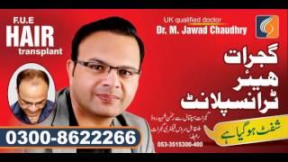 Gujrat Hair Transplant,Best FUE Hair Transplant Center in pakistan