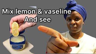 Lemon and Vaseline if you don’t love him or her please don’t do this again please 