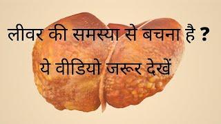  HOW TO CURE NATURALLY FATTY LIVER | DR SAMIR KR. DHARA | FEONNAA AYURVEDA