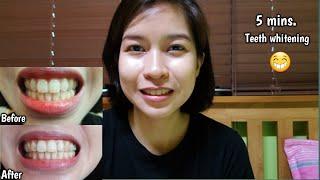 Paano paputiin ang ngipin in 5 minutes (Effective teeth whitening)