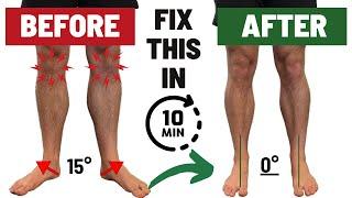 How To Fix Duck Feet FAST | Fixing Ankle Dorsiflexion, Tibial IR, & Hip IR