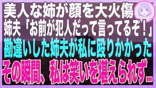 【スカッと】姉「妹に顔に火をつけられた！」妄想癖の姉を信じた家族はブチギレ→私は猛暑の外へ裸足で閉め出されると