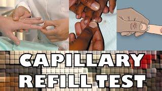 CAPILLARY REFILL TEST - FAST & SIMPLE - Ohio University - Human Anatomy & Physiology