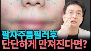 팔자주름 필러시술 6개월 뒤에도~ 딱딱하거나 붓는 증상이 나타난다면? 병원에 방문해야합니다! #팔자필러부작용 #필러제거 #필러부작용