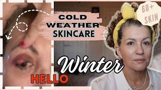 COLD, STYE & BEAUTY// How To Stay Glowing In WINTER//Say Hello to a huge & Painful Stye