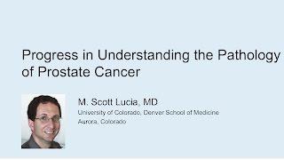 Progess in Understanding Pathology of Prostate Cancer