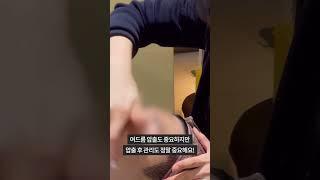 피부관리사가 알려주는 여드름 압출, 진정 방법 + 재생크림 추천