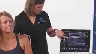 Overview of the Konica Minolta SONIMAGE HS2 Ultrasound System