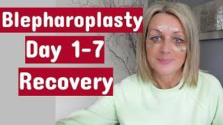 My Eye Surgery (Upper&Lower blepharoplasty) / Day 1-7 Recovery