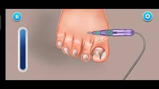 ASMR Foot Athlete s toenails treatment animation