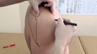 Плечевой сустав. Причины боли, лечение  The shoulder joint. Causes of pain treatment.