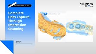 Intraoral Scan Course EP27｜Complete Data Capture Through Impression Scanning