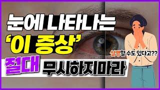 눈에 나타나는 이런 증상 절대 그냥 지나치시면 안됩니다!-사물이 찌그러져 보인다면 이 질환을 의심해봐라-