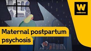 Postpartum psychosis: a mother’s story | Wellcome