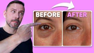 HOW TO: MAKE EYE BAGS VANISH IN SECONDS! FULL DEMO!