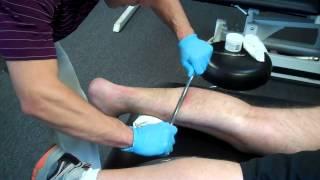 Graston Technique - Foot & Plantar Fasciitis