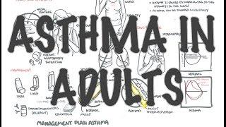 Adult Asthma - Overview (signs and symptoms, pathophysiology, investigations and treatment)