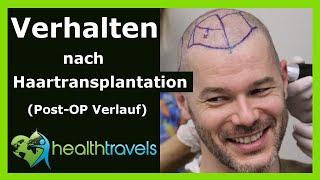 Verhalten nach Haartransplantation [Post-OP Verlauf] - Health Travels informiert