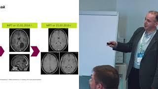 Противоопухолевое лечение церебральных метастазов солидных опухолей. Насхлеташвили Д.Р. (Москва)