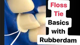 FLOSS LIGATURE BASICS  (FLOSS TIE)