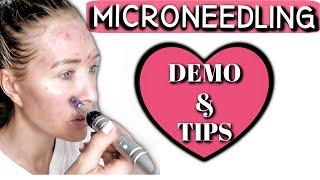 Microneedling at Home with Dr. Pen A6! | DEMO & TIPS! | How to Microneedle your Face!