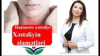 Haşimoto xəstəliyi,  Haşimoto xəstəliyinin əlamətləri nələrdir? Dr.Venera Cəmilova