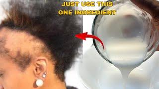 No Joke! This is Exactly what you need to grow your hair 100 times faster in 2024!